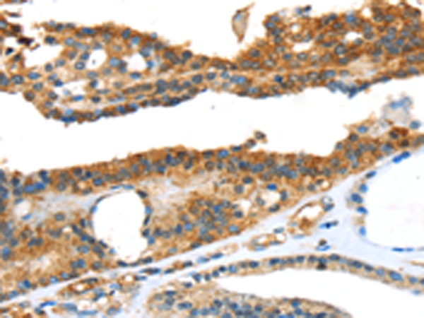 Rabbit Polyclonal Antibody to SNAI3