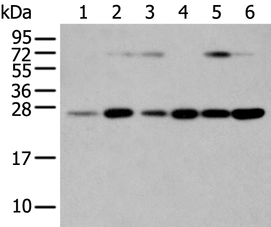 Rabbit Polyclonal Antibody to SNAP23