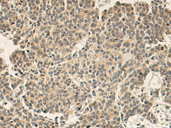 Rabbit Polyclonal Antibody to SNAP47