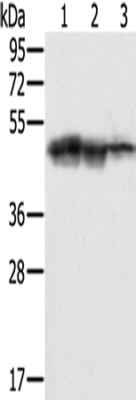 Rabbit Polyclonal Antibody to SMARCB1