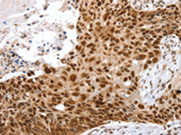 Rabbit Polyclonal Antibody to SNX15