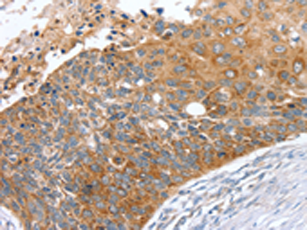 Rabbit Polyclonal Antibody to SNX27