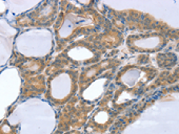 Rabbit Polyclonal Antibody to SNX4