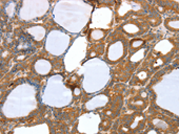 Rabbit Polyclonal Antibody to SNX11