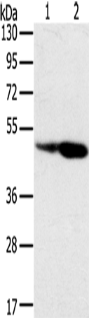Rabbit Polyclonal Antibody to SNX8