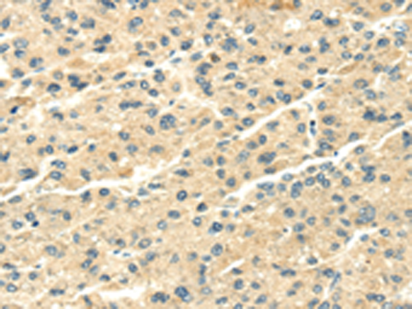 Rabbit Polyclonal Antibody to SNX20