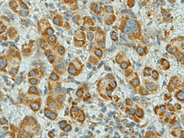 Rabbit Polyclonal Antibody to SFTPA1