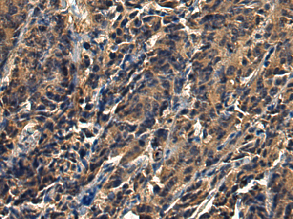 Rabbit Polyclonal Antibody to SPRY2