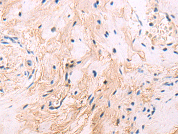 Rabbit Polyclonal Antibody to SPRY3