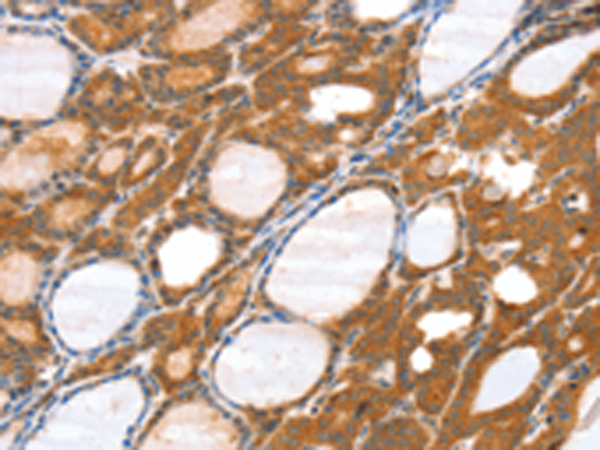 Rabbit Polyclonal Antibody to SRGAP3