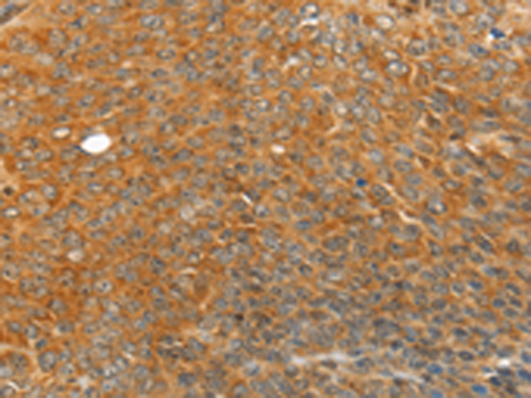 Rabbit Polyclonal Antibody to TRIM21