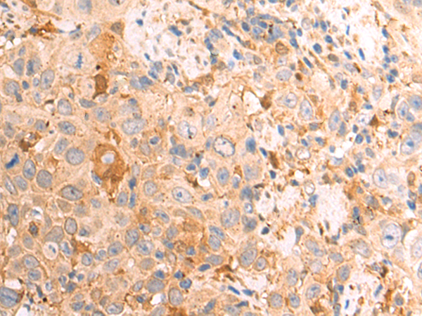 Rabbit Polyclonal Antibody to RO60