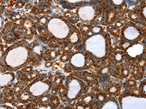 Rabbit Polyclonal Antibody to SSBP1