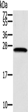 Rabbit Polyclonal Antibody to SSX1