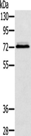 Rabbit Polyclonal Antibody to SSX2IP