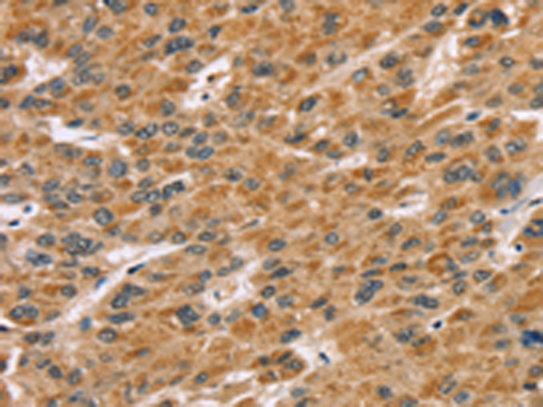 Rabbit Polyclonal Antibody to SDCBP