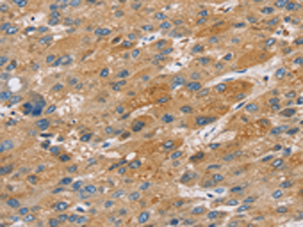 Rabbit Polyclonal Antibody to ST18