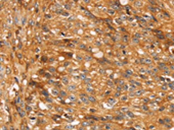 Rabbit Polyclonal Antibody to STC1
