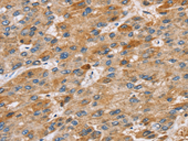 Rabbit Polyclonal Antibody to STARD8