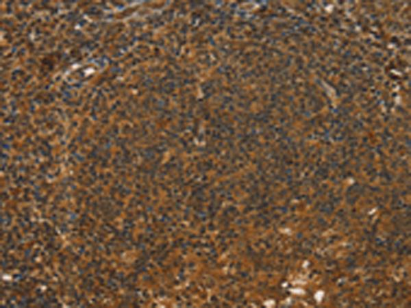 Rabbit Polyclonal Antibody to STAR