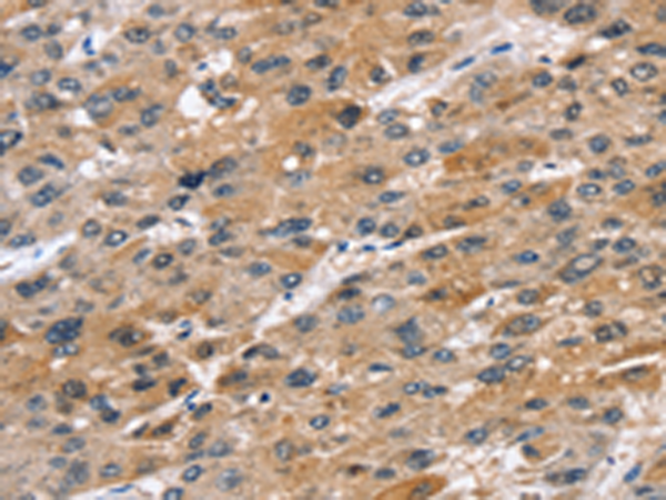Rabbit Polyclonal Antibody to STK33
