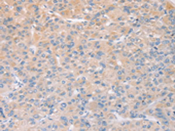 Rabbit Polyclonal Antibody to STK16