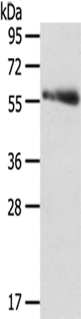 Rabbit Polyclonal Antibody to SRPK3