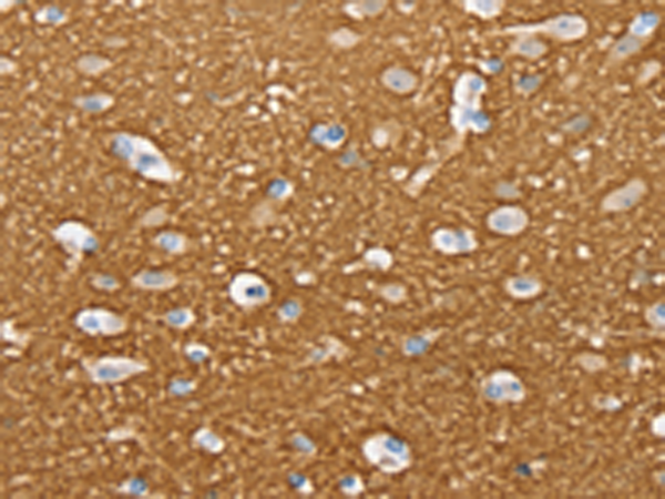 Rabbit Polyclonal Antibody to STXBP1