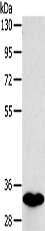 Rabbit Polyclonal Antibody to SULT1B1