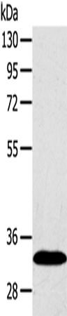 Rabbit Polyclonal Antibody to SULT2A1