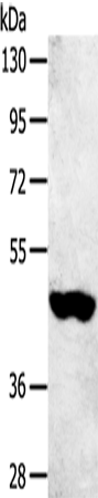 Rabbit Polyclonal Antibody to SULT2B1