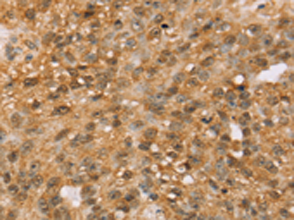 Rabbit Polyclonal Antibody to MED22
