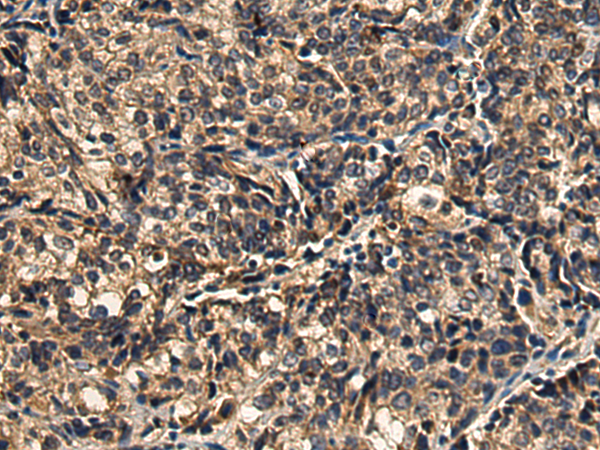 Rabbit Polyclonal Antibody to SFTPA2