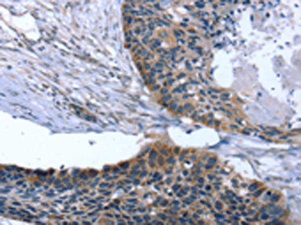 Rabbit Polyclonal Antibody to ARMC10