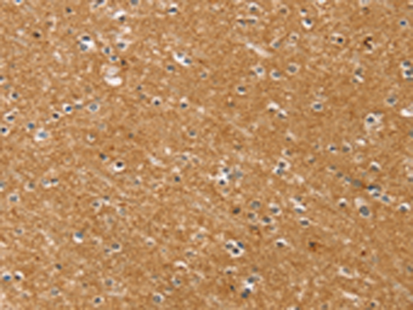 Rabbit Polyclonal Antibody to SYTL5