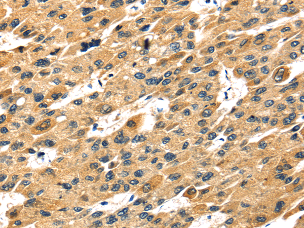 Rabbit Polyclonal Antibody to STX7