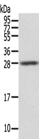 Rabbit Polyclonal Antibody to STX8