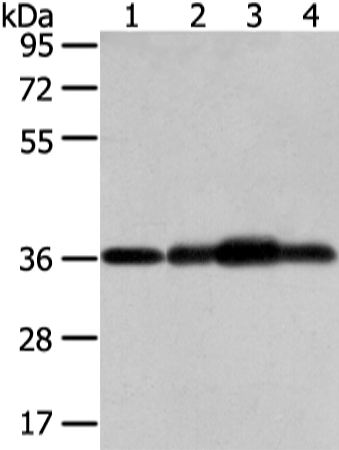 Rabbit Polyclonal Antibody to STX12
