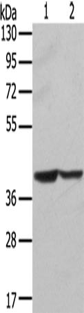 Rabbit Polyclonal Antibody to STX16
