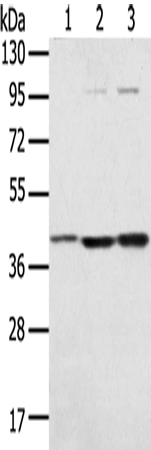 Rabbit Polyclonal Antibody to STX18