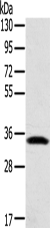 Rabbit Polyclonal Antibody to STX11
