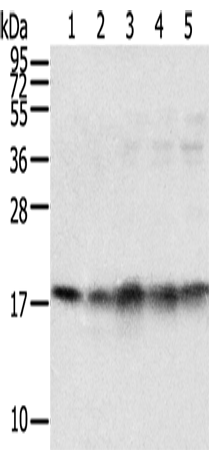 Rabbit Polyclonal Antibody to TAF11