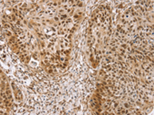 Rabbit Polyclonal Antibody to TAF12