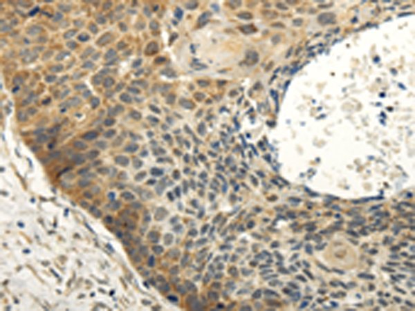 Rabbit Polyclonal Antibody to ABCB7