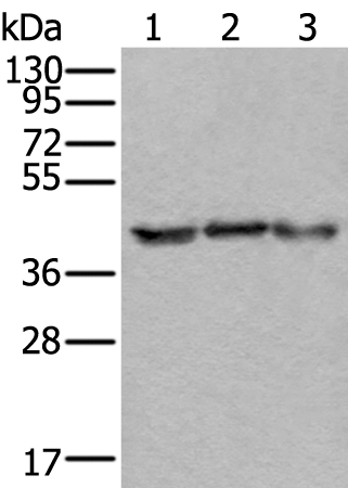Rabbit Polyclonal Antibody to TBP