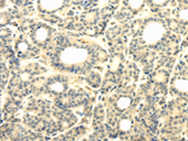 Rabbit Polyclonal Antibody to TBC1D22A