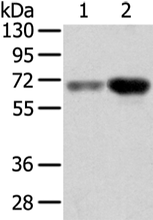 Rabbit Polyclonal Antibody to TBL1X