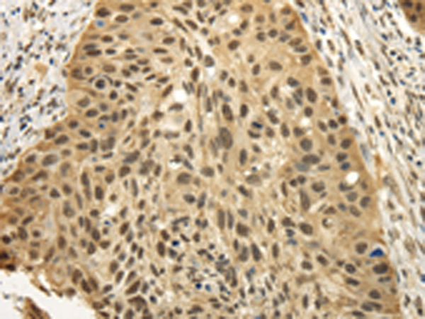 Rabbit Polyclonal Antibody to TBL1XR1