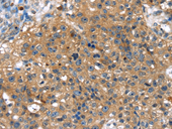Rabbit Polyclonal Antibody to TBX10