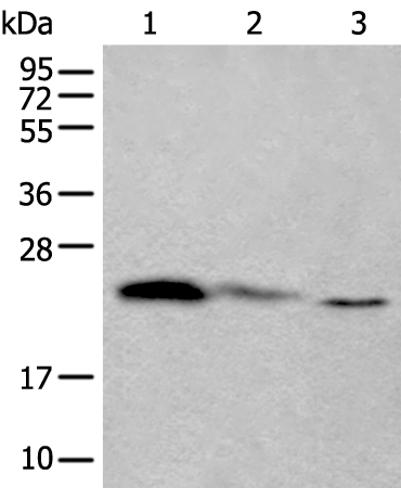 Rabbit Polyclonal Antibody to TPT1